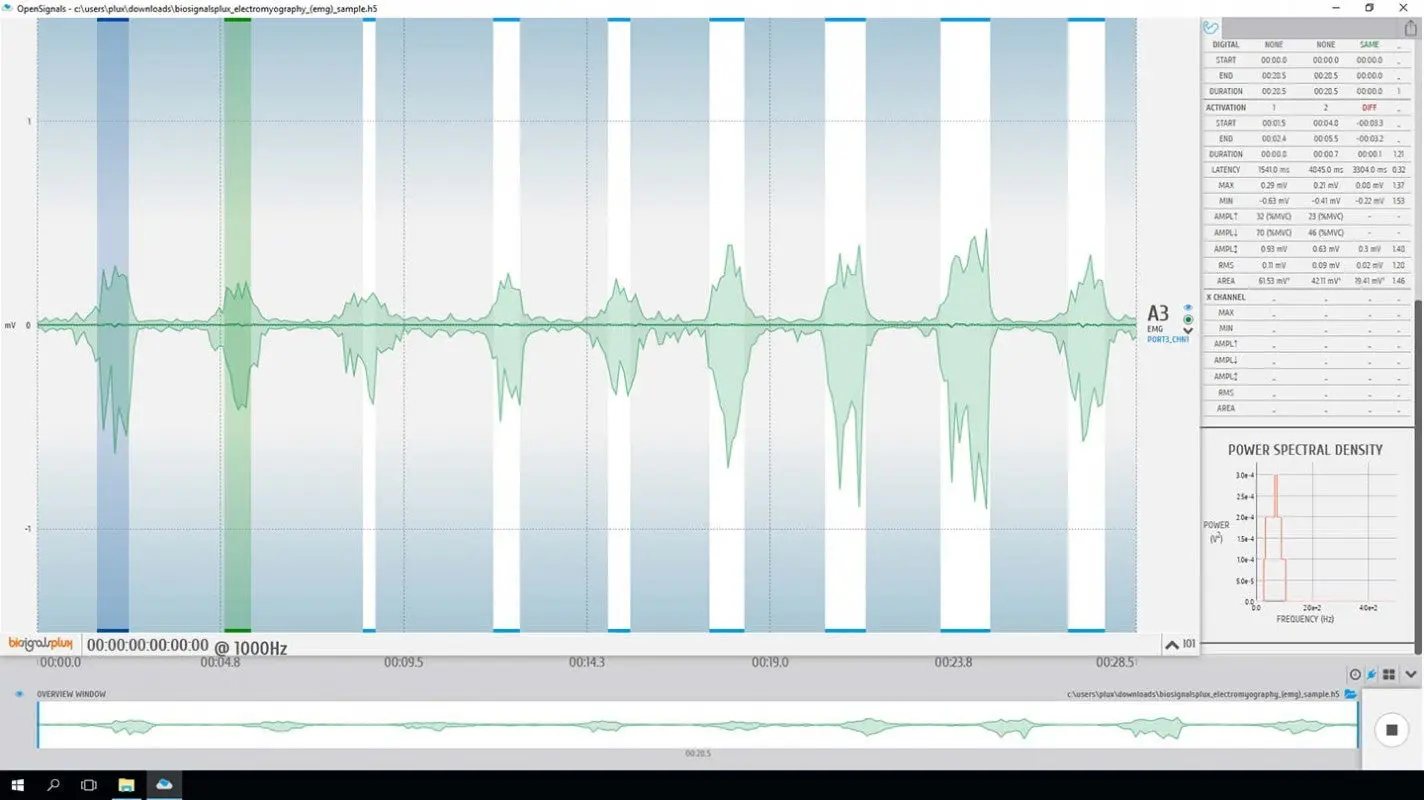 Electromyography (EMG) Analysis Add-on