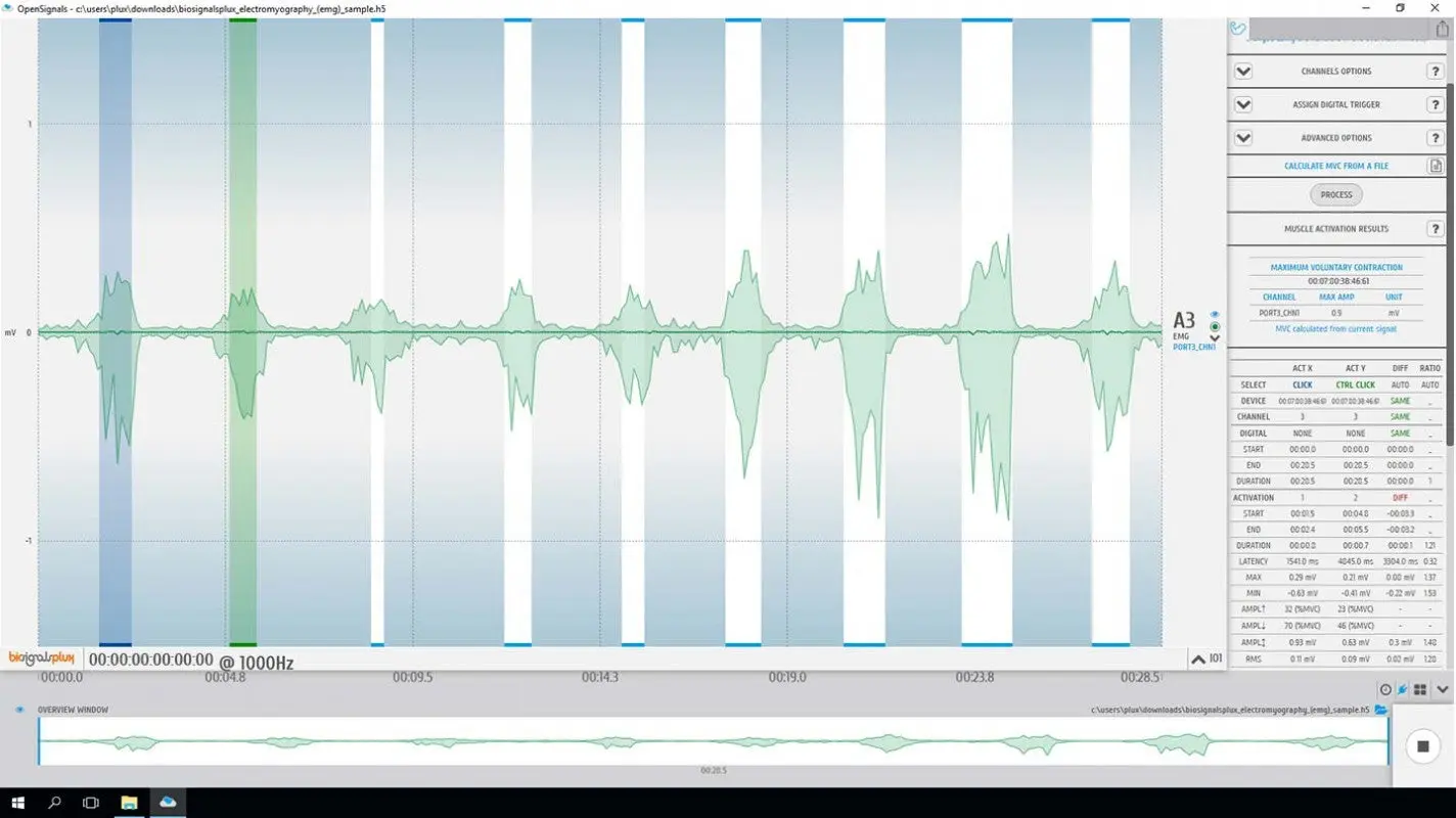 Electromyography (EMG) Analysis Add-on - Image 2
